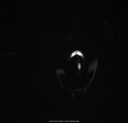 Brain MRI scans, animated